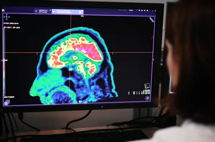 کشف داروی آلزایمر با مشارکت جامعه علمی کانادا