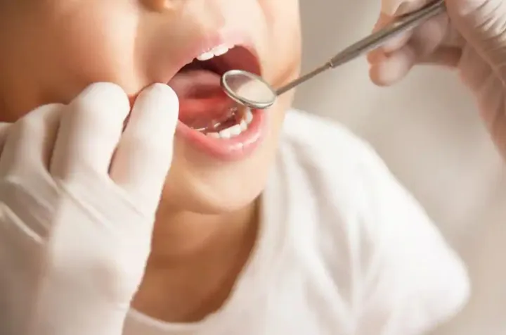 برای دریافت کمک ۶۵۰ دلاری مراقبت دندانپزشکی کودکان چند روز بیشتر وقت ندارید